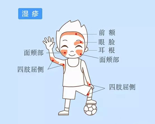 三个小偏方治疗阴囊湿疹有奇效
